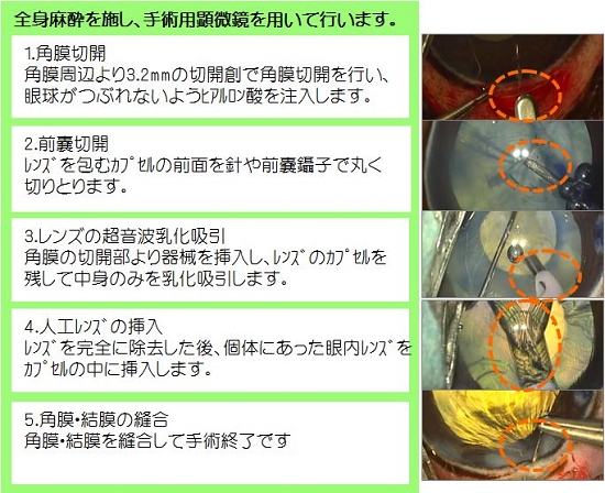 白内障 手術 費用 犬